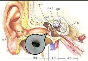 耳朵内部图片,内部结构图解解析